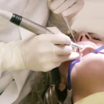 ways to Take Care Of Your Teeth
